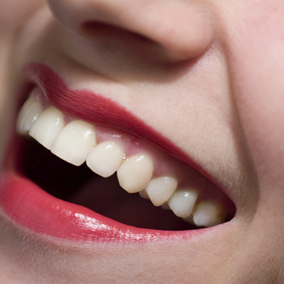 Cosmetic Dental